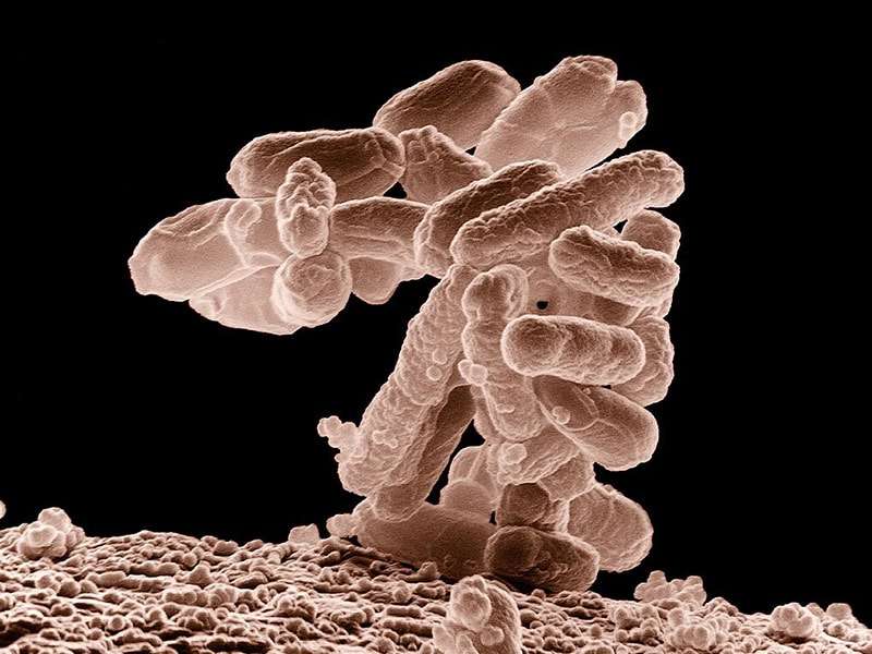 E-Coli Bacteria in Trash Bin before Cleaning